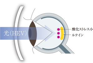 ルティーナを装用しつづけた眼