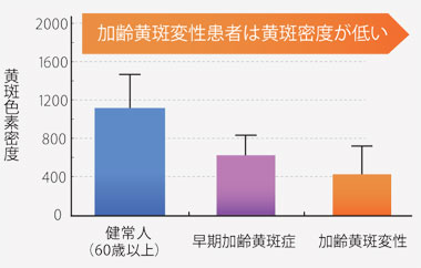 加齢黄斑変性と黄斑色素の関係性